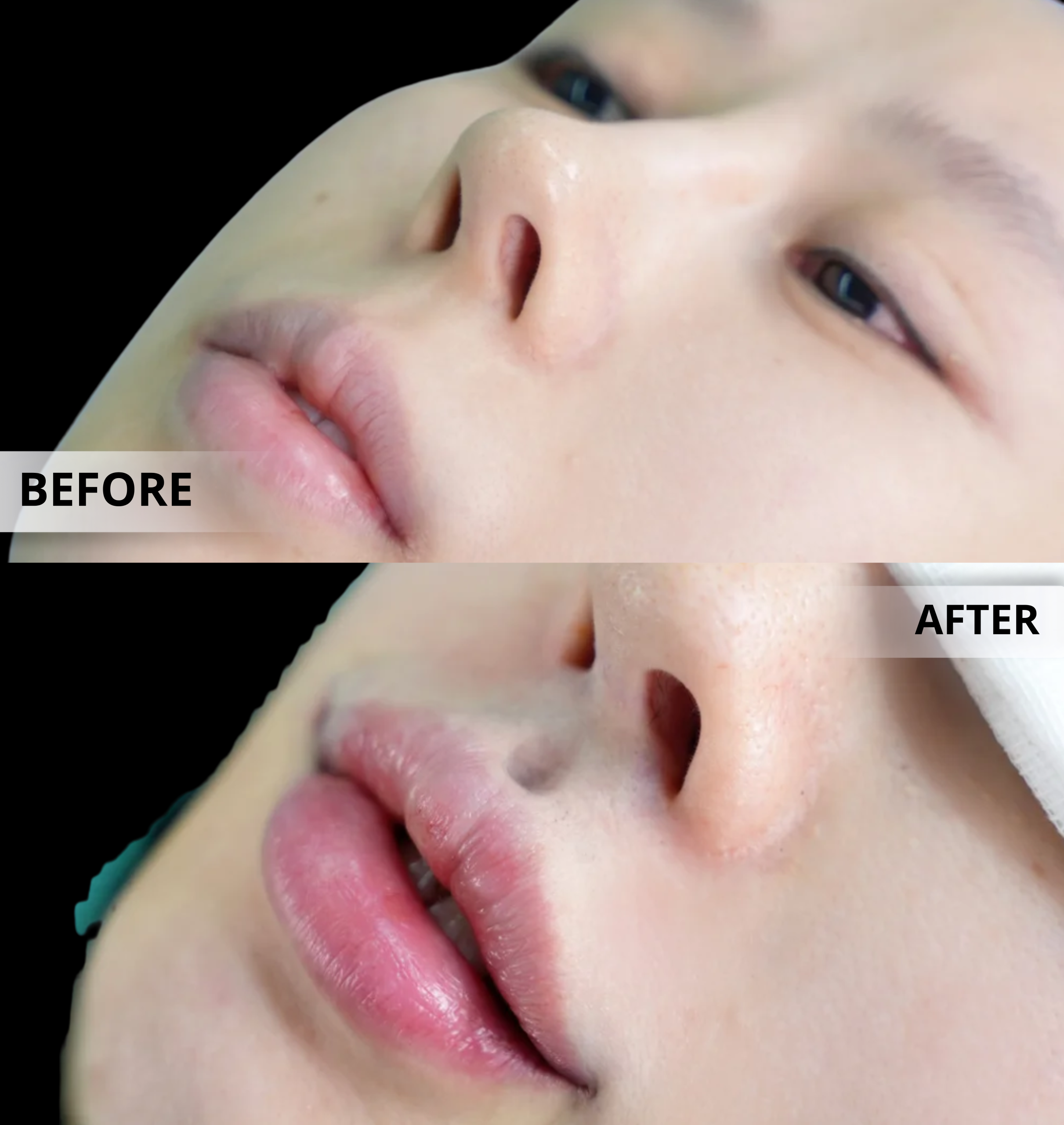 Before and After